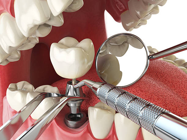 Best Emergency Dental Surgery in Labarque Creek, MO